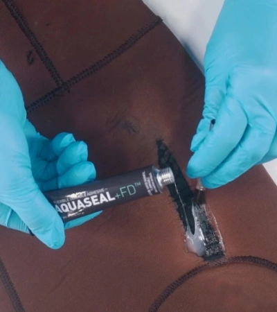 McNett  Aquasure+FD 2x7g REPAIR ADHESIVE